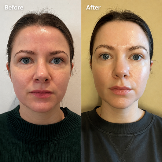 De-Puffing Gua Sha Sculpting Gel
