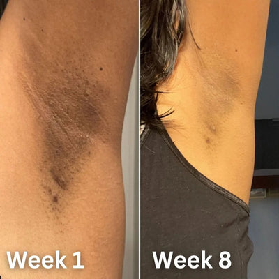 Kojic + Turmeric Brightening Deodorant