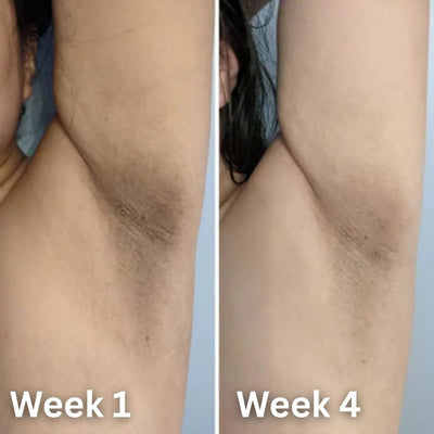 Kojic + Turmeric Brightening Deodorant